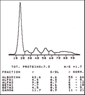 Description: https://www.ddsdiagnostic.ro/imagini/literatura/fig_B.jpg