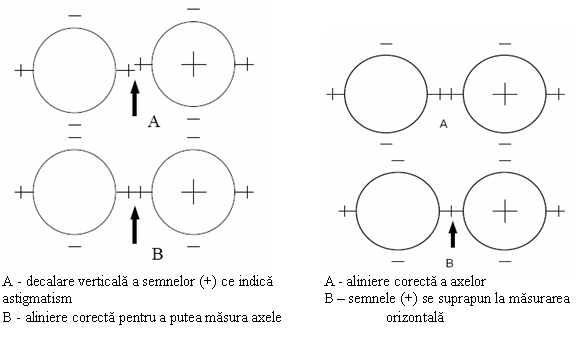 Text Box: 
A - decalare verticala a semnelor (+) ce indica A - aliniere corecta a axelor
astigmatism B - semnele (+) se suprapun la masurarea 
B - aliniere corecta pentru a putea masura axele orizontala
