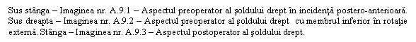 Text Box: Sus stanga - Imaginea nr. A.9.1 - Aspectul preoperator al soldului drept in incidenta postero-anterioara. Sus dreapta - Imaginea nr. A.9.2 - Aspectul preoperator al soldului drept cu membrul inferior in rotatie externa. Stanga - Imaginea nr. A.9.3 - Aspectul postoperator al soldului drept.